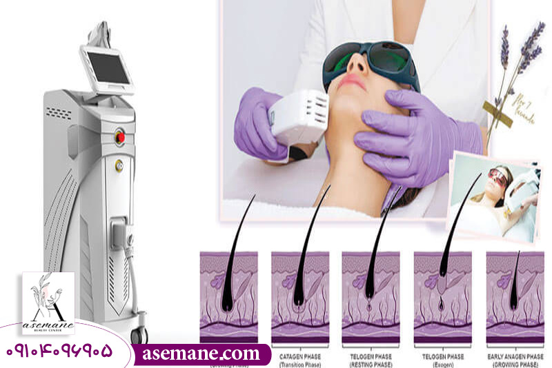 انواع تکنولوژی های لیزر موهای زائد 